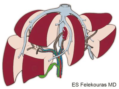 liver_2_20130508_1582887785b