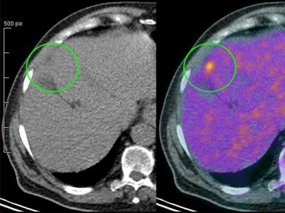 mcrc-pet-head